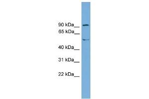 WB Suggested Anti-TEC Antibody Titration:  0. (NR4A3 抗体  (Middle Region))