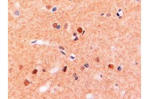 ABIN190775 (2µg/ml) staining of paraffin embedded Human Brain. (CD11b 抗体  (Internal Region))