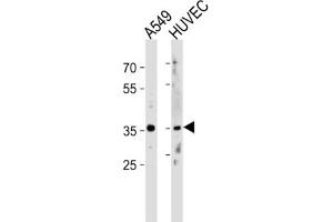 Western Blotting (WB) image for anti-Homeobox B5 (HOXB5) antibody (ABIN3002824)