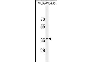 CADM1 Antibody (N-term) (ABIN654660 and ABIN2844356) western blot analysis in MDA-M cell line lysates (35 μg/lane).