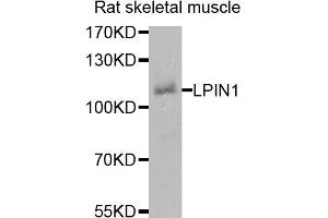Western blot analysis of extracts of rat skeletal muscle cells, using LPIN1 antibody. (Lipin 1 抗体)
