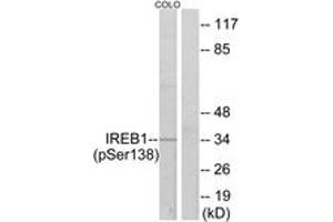 Western Blotting (WB) image for anti-Aconitase 1 (ACO1) (AA 106-155), (pSer138) antibody (ABIN1531675) (Aconitase 1 抗体  (pSer138))