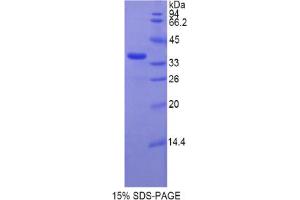 SDS-PAGE analysis of Rat TERT Protein.