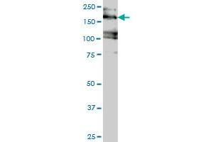 EIF4G3 monoclonal antibody (M02), clone 1D7 Western Blot analysis of EIF4G3 expression in Jurkat . (EIF4G3 抗体  (AA 1-515))