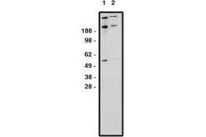 Image no. 1 for anti-Zinc Finger Protein GLI1 (GLI1) antibody (ABIN793724) (GLI1 抗体)