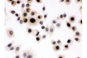 Anti- DAXX Picoband antibody,ICC ICC: SMMC-7721 Cell