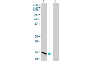 Western Blot analysis of CHRAC1 expression in transfected 293T cell line by CHRAC1 monoclonal antibody (M11), clone 4E7. (CHRAC1 抗体  (AA 1-96))