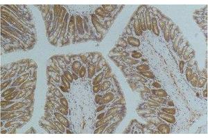 Immunohistochemistry of paraffin-embedded Mouse colon tissue using AMPK alpha1 Monoclonal Antibody at dilution of 1:200.
