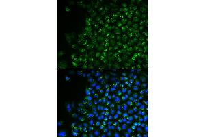 Immunofluorescence (IF) image for anti-Pyruvate Dehydrogenase (Lipoamide) alpha 1 (PDHA1) (AA 30-390) antibody (ABIN3023697)