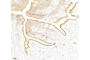 Immunohistochemistry analysis of paraffin-embedded mouse small intestine using PLS1 (ABIN7075096) at dilution of 1: 2000 (PLS1 抗体)