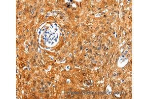 Immunohistochemistry of Human tonsil using NCOR1 Polyclonal Antibody at dilution of 1:100 (NCOR1 抗体)