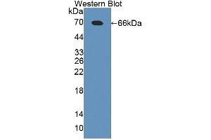 Western blot analysis of the recombinant protein. (TLR5 抗体  (AA 327-646))