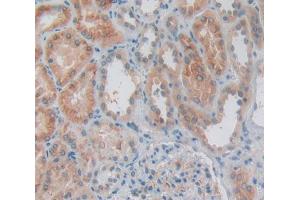 Used in DAB staining on fromalin fixed paraffin- embedded Kidney tissue (IL1A 抗体  (AA 98-271))