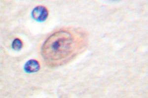 Image no. 1 for anti-CSE1 Chromosome Segregation 1-Like (CSE1L) antibody (ABIN265374) (Exportin 2 抗体)
