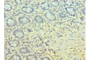 Immunohistochemistry of paraffin-embedded human small intestine tissue using ABIN7162803 at dilution of 1:100