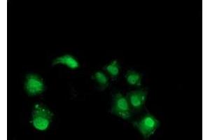 Anti-NHEJ1 mouse monoclonal antibody (ABIN2454029) immunofluorescent staining of COS7 cells transiently transfected by pCMV6-ENTRY NHEJ1 (RC203393). (NHEJ1 抗体)
