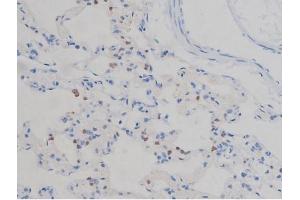 ABIN6267335 at 1/200 staining Rat lung tissue sections by IHC-P. (IGF1R 抗体  (pTyr1165, pTyr1166))