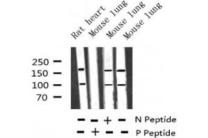 Western blot analysis of Phospho-IGF1R (Tyr1346) expression in various lysates (IGF1R 抗体  (pTyr1346))