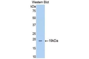 Western blot analysis of the recombinant protein. (Thrombospondin 1 抗体  (AA 327-478))