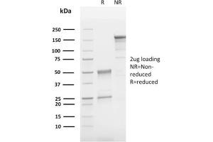 SDS-PAGE Analysis Purified CD63 Mouse Monoclonal Antibody (LAMP3/2790).