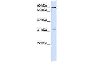 LRRC8B antibody used at 1 ug/ml to detect target protein. (LRRC8B 抗体  (Middle Region))