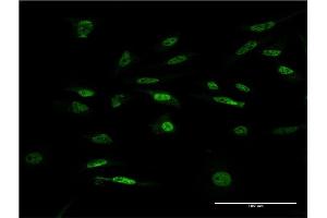 Immunofluorescence of monoclonal antibody to FOXK2 on HeLa cell.