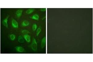 Immunofluorescence analysis of HeLa cells, using Calnexin (Ab-583) Antibody. (Calnexin 抗体  (AA 543-592))