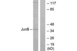 Western blot analysis of extracts from HeLa cells, using JunB (Ab-259) Antibody. (JunB 抗体  (AA 226-275))