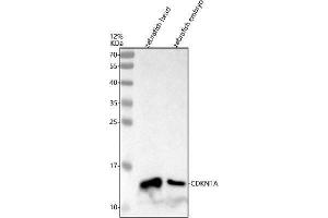Western blot analysis of p21/CDKN1A using anti-p21/CDKN1A antibody (AZA0A8M1RFS1).