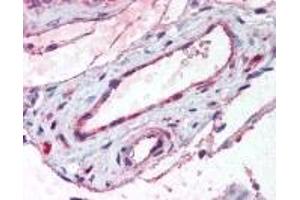 Immunohistochemistry (IHC) image for anti-ADAM Metallopeptidase with Thrombospondin Type 1 Motif, 1 (ADAMTS1) (Internal Region) antibody (ABIN2469276)