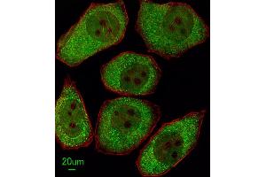 Immunofluorescence (IF) image for anti-Arachidonate 12-Lipoxygenase (ALOX12) (AA 618-650), (C-Term) antibody (ABIN652825)