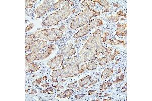 IHC analysis of SMARCAD1 using anti-SMARCAD1 antibody (ABIN6719539).