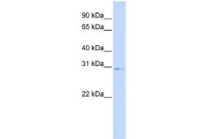 WB Suggested Anti-HOXA9 Antibody Titration:  0. (HOXA9 抗体  (Middle Region))