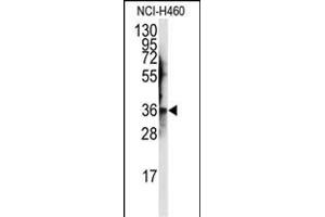 Western blot analysis of anti-JTV1 Antibody (Center) (ABIN389383 and ABIN2839480) in NCI- cell line lysates (35 μg/lane). (AIMP2 抗体  (AA 156-184))