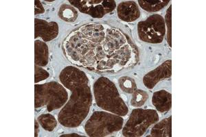 Immunohistochemical staining (Formalin-fixed paraffin-embedded sections) of human kidney with NAPRT1 monoclonal antibody, clone CL0366  shows strong cytoplasmic immunoreactivity in renal tubules. (NAPRT1 抗体)