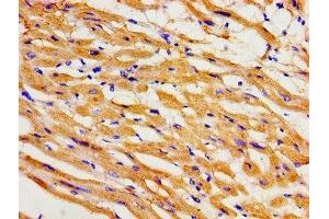 Immunohistochemistry of paraffin-embedded human heart tissue using ABIN7163993 at dilution of 1:100 (KCNH2 抗体  (AA 894-1137))