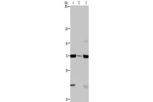 Gel: 6 % SDS-PAGE, Lysate: 40 μg, Lane 1-3: LoVo cells, human testis tissue, A549 cells, Primary antibody: ABIN7129423(FAAH Antibody) at dilution 1/400, Secondary antibody: Goat anti rabbit IgG at 1/8000 dilution, Exposure time: 2 minutes (FAAH 抗体)