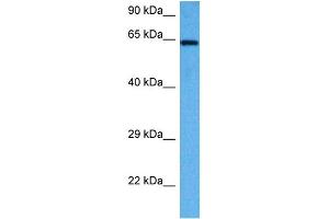 Host:  Rabbit  Target Name:  AIFM1  Sample Tissue:  Mouse Liver  Antibody Dilution:  1ug/ml (AIF 抗体  (C-Term))