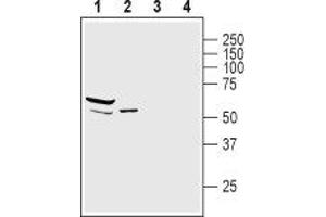 Western blot analysis of mouse heart lysate (lanes 1 and 3) and rat skeletal muscle membranes (lanes 2 and 4): - 1,2. (SNTA1 抗体  (Intracellular, PH1 Domain))