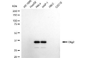 Western blotting analysis using Olig2 antibody (ABIN7799699).