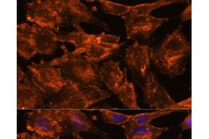 Immunofluorescence analysis of C6 cells using ITSN2 Polyclonal Antibody at dilution of 1:100. (Intersectin 2 抗体)