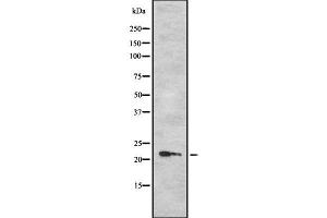 Western blot analysis of TPD52L1 using LOVO whole cell lysates (TPD52L1 抗体  (N-Term))