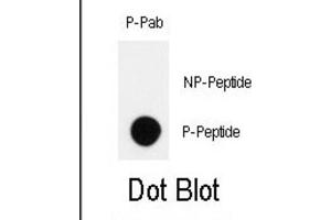 Dot Blot (DB) image for anti-Homeodomain Interacting Protein Kinase 2 (HIPK2) (pTyr361) antibody (ABIN3001890) (HIPK2 抗体  (pTyr361))