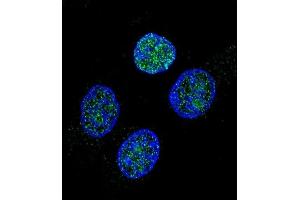 Confocal immunofluorescent analysis of PROC Antibody (Center) (ABIN657466 and ABIN2846494) with Hela cell followed by Alexa Fluor 488-conjugated goat anti-rabbit lgG (green). (PROC 抗体  (AA 177-206))