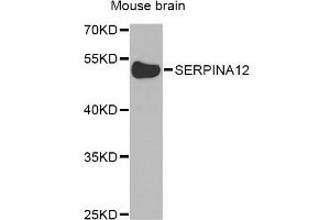 Western blot analysis of extracts of mouse brain, using SERPINA12 Antibody. (SERPINA12 抗体)