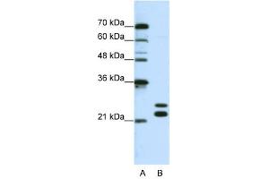 CSDC2 antibody used at 0. (CSDC2 抗体  (N-Term))
