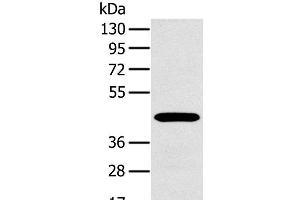 Western Blot analysis of A375 cell using MAGEA10 Polyclonal Antibody at dilution of 1:400 (MAGEA10 抗体)