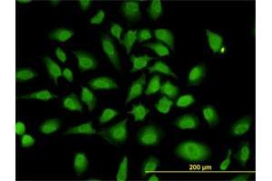 Immunofluorescence (IF) image for anti-Poly(rC) Binding Protein 2 (PCBP2) (AA 1-362) antibody (ABIN562121)