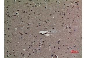 Immunohistochemistry (IHC) analysis of paraffin-embedded Human Brain, antibody was diluted at 1:100. (HMGB1 抗体  (acLys12))