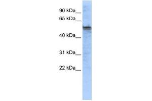 WB Suggested Anti-TPH2 Antibody Titration:  0. (Tryptophan Hydroxylase 2 抗体  (Middle Region))